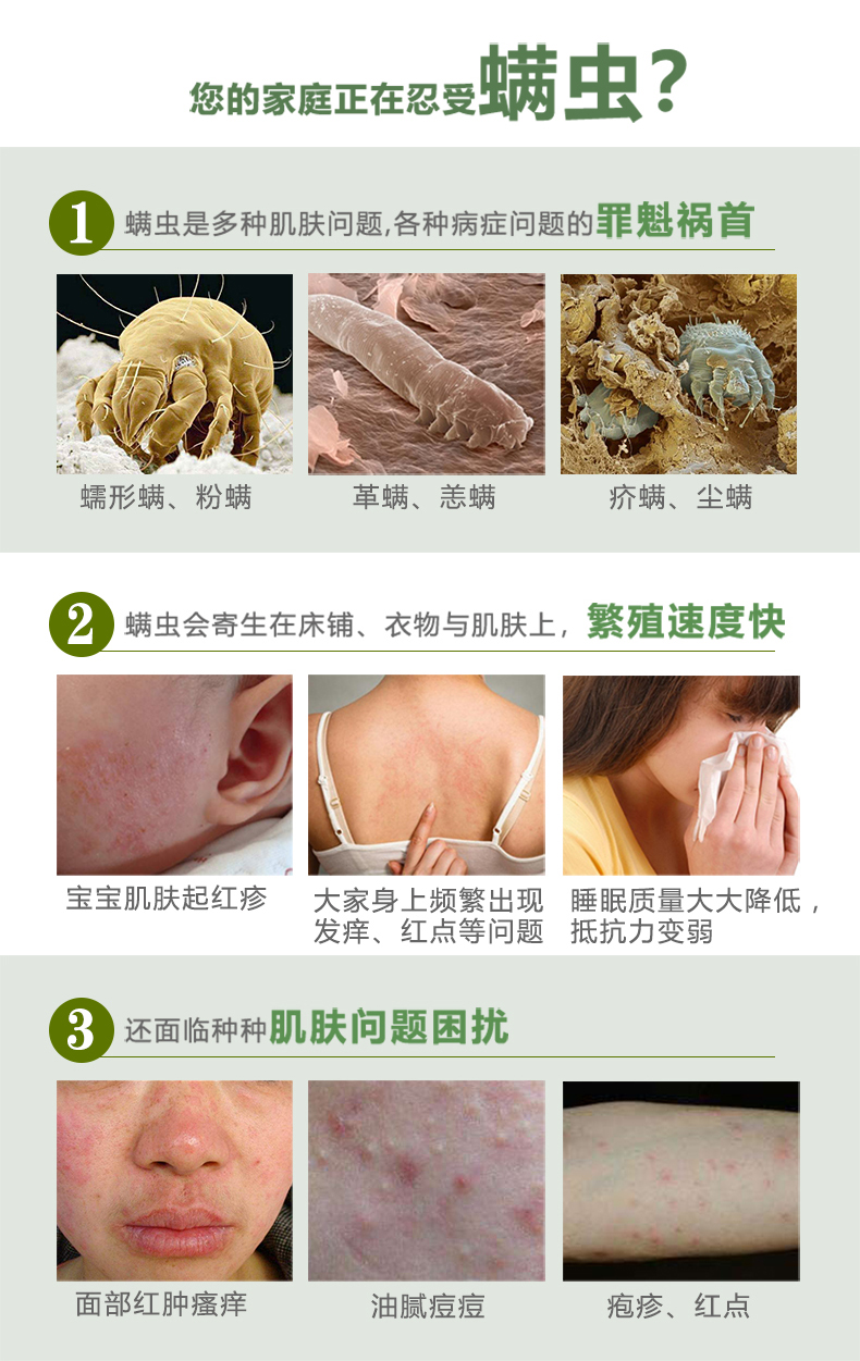 美澜妮云南本草青花椒除螨喷雾剂家用室内杀螨虫免洗植物去螨虫(图3)